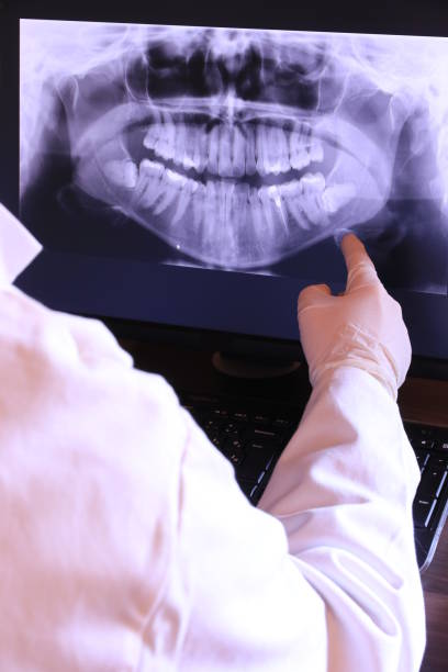 Best Broken or Cracked Tooth Emergency Dentist in Santa Clara, NM